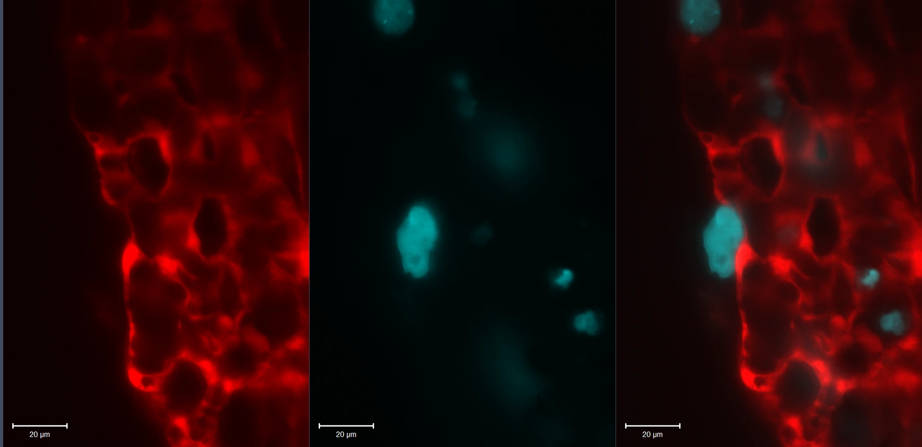 Fluorescence microscopy showing a tumor cell in cyan after exiting a blood vessel shown in red, with a merged view and 20 micrometer scale bars.